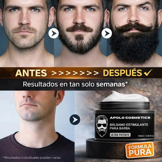 Resultados Reales en 30–60 Días Más Densidad & Barba Visible - El ORIGINAL mas vendido en Latinoamérica